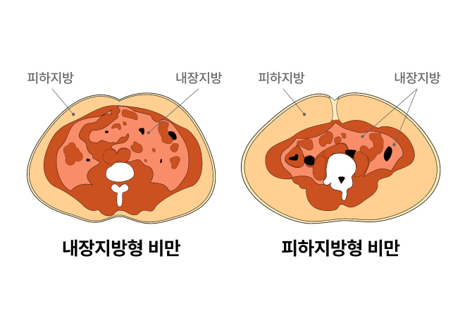 호르몬 케어 다이어트