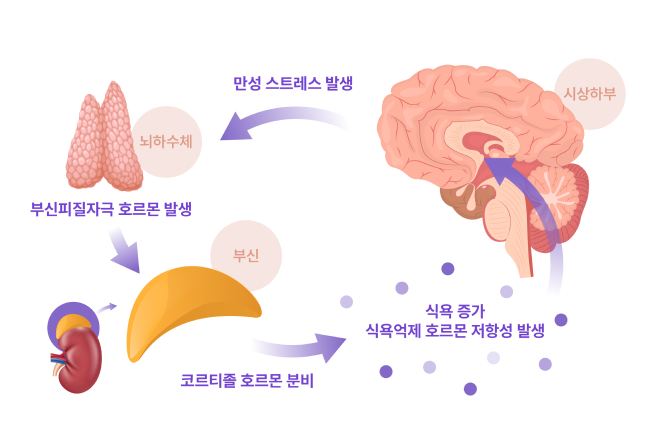 스트레스 케어 다이어트