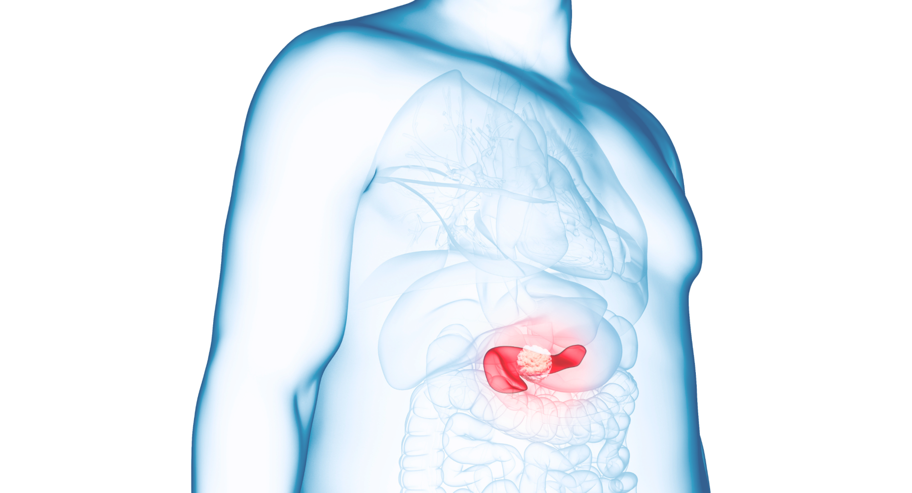 3GO 케어 다이어트